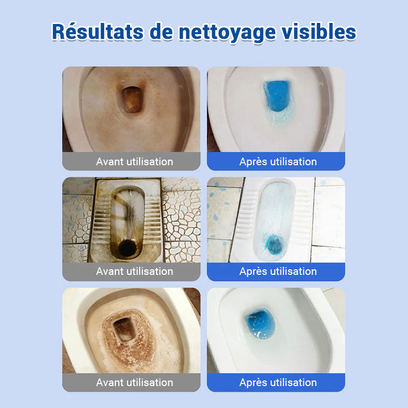 ✨🚽 Comprimés effervescents de nettoyage des toilettes - décontamination, tartre urinaire, alcali urinaire et élimination des odeurs