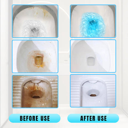 🔥Dernier jour Achetez-en 2, obtenez-en 1 gratuit -💦Bâtonnet nettoyant concentré efficace pour détartrer les toilettes