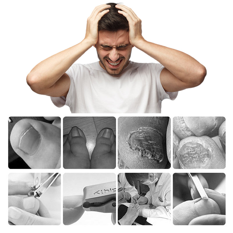 📢📢60 % DE RÉDUCTION !!⏰Coupe-ongles professionnels pour ongles incarnés 7 pièces