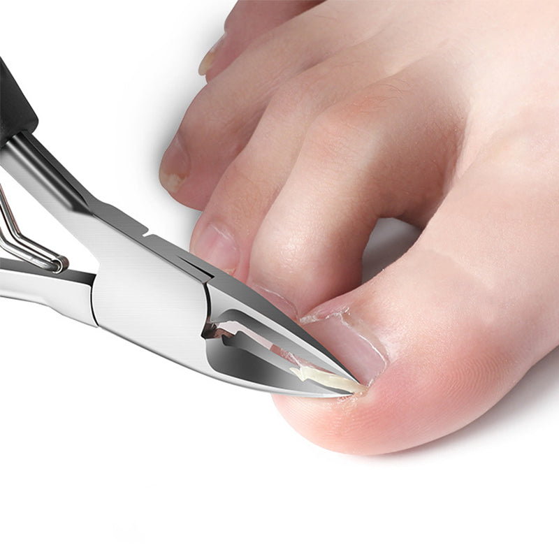 📢📢60 % DE RÉDUCTION !!⏰Coupe-ongles professionnels pour ongles incarnés 7 pièces