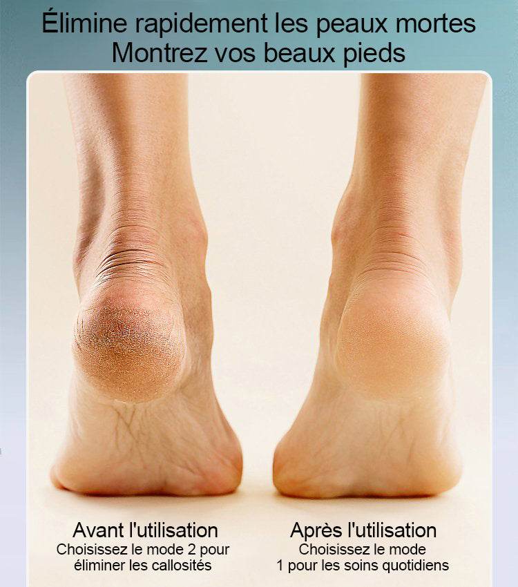 💥Offre à durée limitée💥Extracteur électrique rechargeable de callosités plantaires
