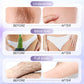 🥳2026 – GRANDES SOLDES🥳💞Plus de 50 000 exemplaires vendus !💚🌸 Épilation douce, totalement indolore ! Crème naturelle pour une peau lisse – 50 % de réduction ! ✨🌿
